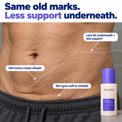 Suverta Recovery Cream – Stretch Mark & Crepey Skin Care
